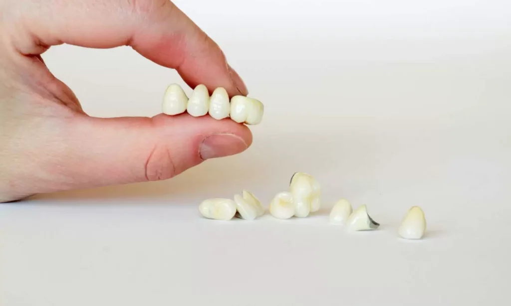 Broken Crown Emergency Dentistry At Carina, Brisbane, Carina Gardens Dental