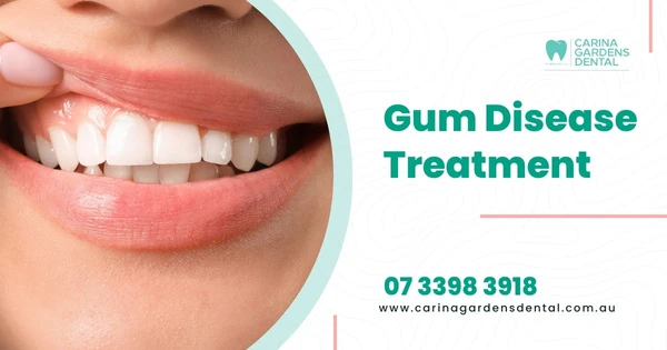 Gum Disease Periodontal Treatment In Carina Gardens Dental Near At Brisbane, Gingivitis