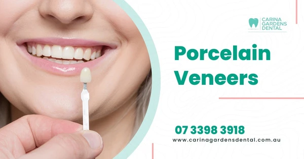Porcelain Veneers In Carina Gardens Dental At Brisbane, Carina