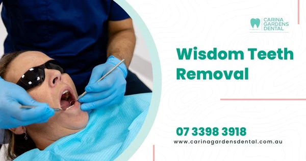 Wisdom Teeth Removal In Carina Gardens Dental Near At Brisbane, Carina