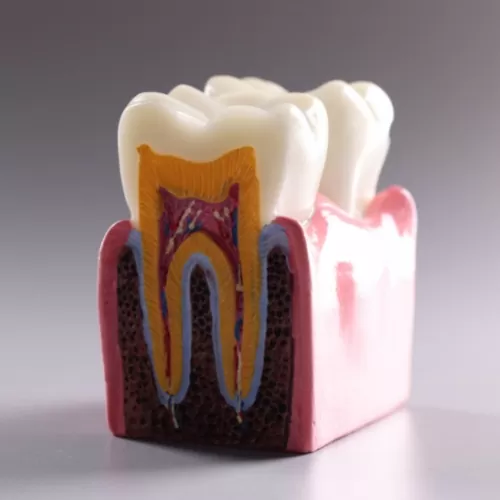 Anatomy Of A Tooth At Carina, Brisbane, Carina Gardens Dental