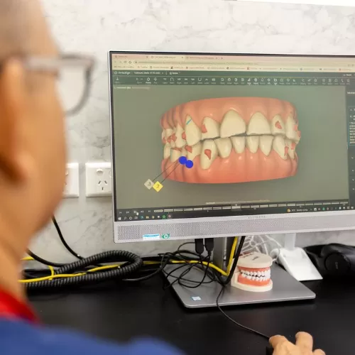 Custom Cosmetic Treatments At Carina, Brisbane, Carina Gardens Dental