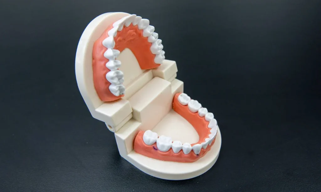 Dental Crowns In Carina Gardens Dental At Brisbane, Carina