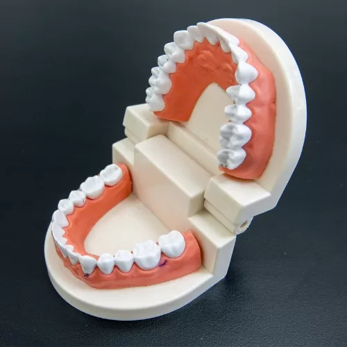 Dental Crowns Near Carina, Brisbane, Carina Gardens Dental