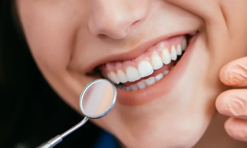 Periodontal Treatment Aftercare At Carina, Brisbane, Carina Gardens Dental