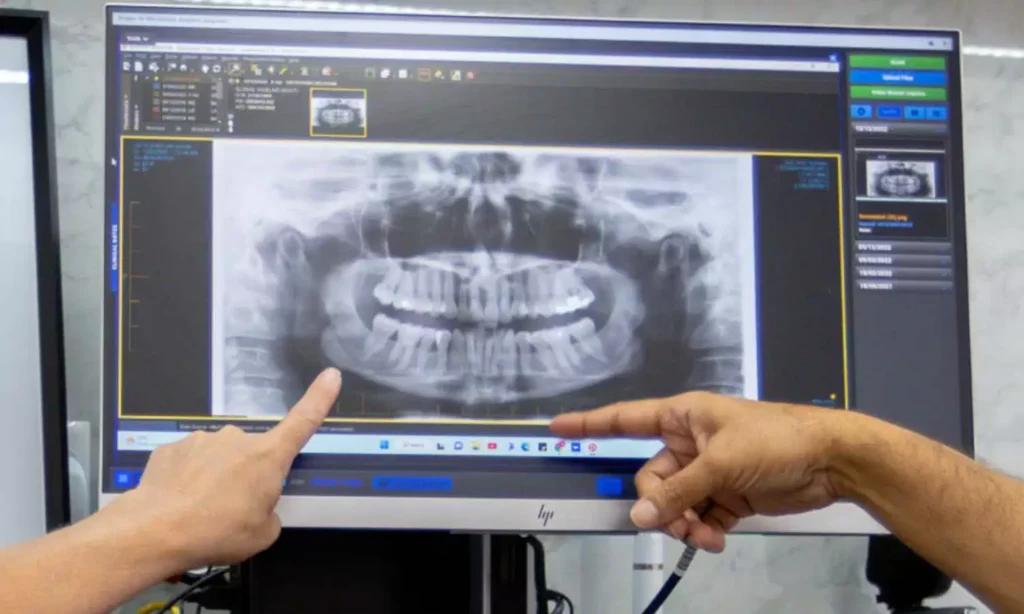 Preventative Dental Care At Carina, Brisbane, Carina Gardens Dental
