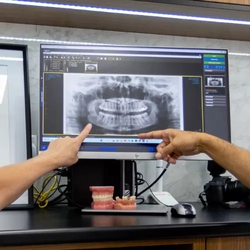 Benefits Of Dental Implants At Carina, Brisbane, Carina Gardens Dental