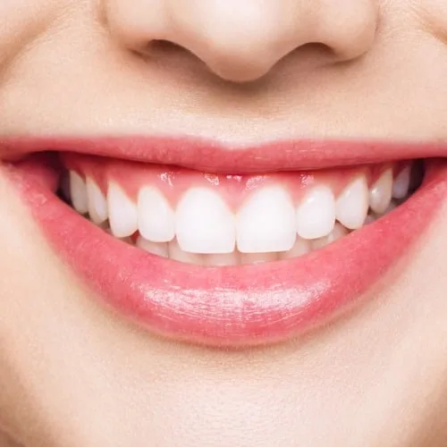 What Happened To My Teeth At Carina, Brisbane, Carina Gardens Dental
